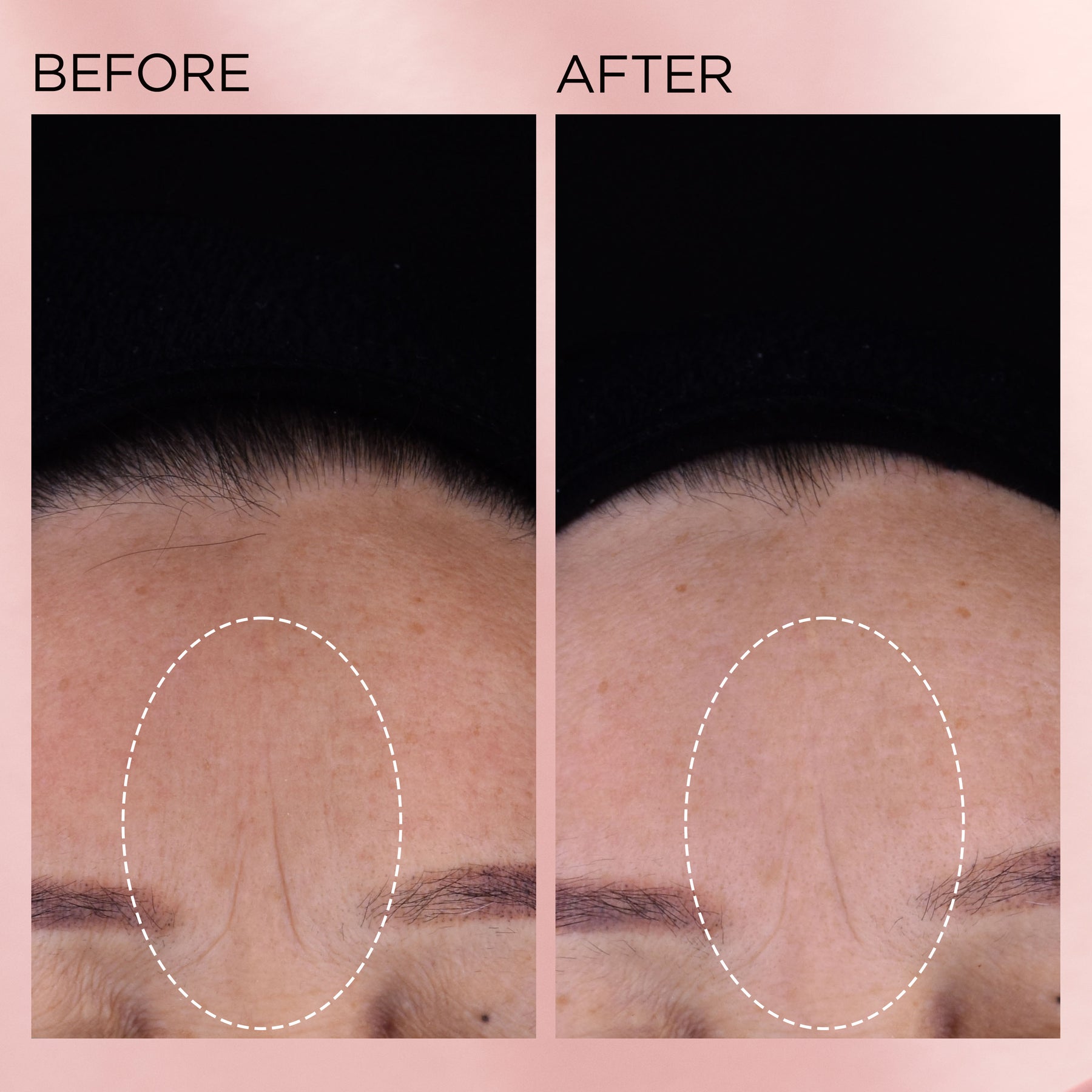 Retinol + HPR Ceramide Capsules Rapid Skin-Renewing Serum